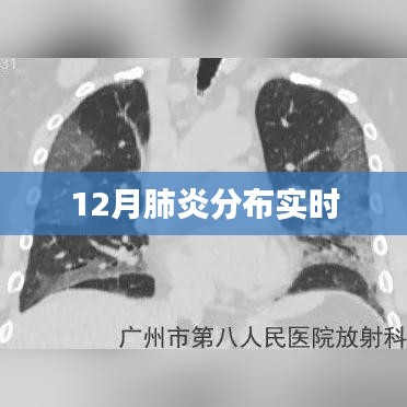 肺炎疫情分布實時情況分析