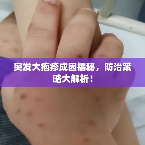 突發(fā)大皰疹成因揭秘，防治策略大解析！