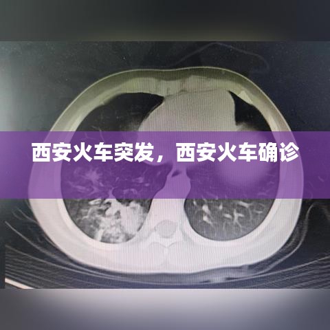 西安火車突發(fā)，西安火車確診