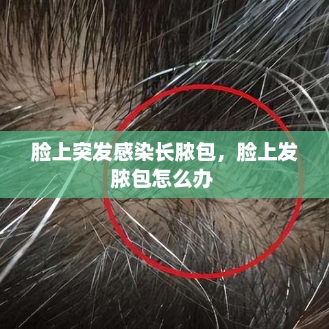 臉上突發(fā)感染長膿包，臉上發(fā)膿包怎么辦