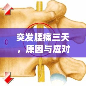突發(fā)腰痛三天，原因與應(yīng)對(duì)方法探討