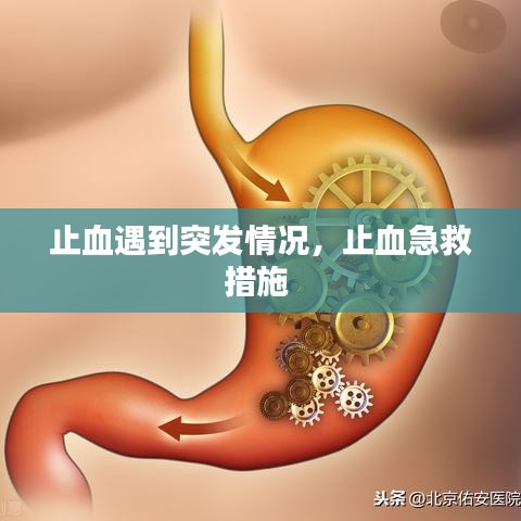 止血遇到突發(fā)情況，止血急救措施 