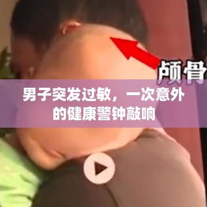 男子突發(fā)過(guò)敏，一次意外的健康警鐘敲響