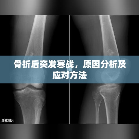 骨折后突發(fā)寒戰(zhàn)，原因分析及應(yīng)對(duì)方法