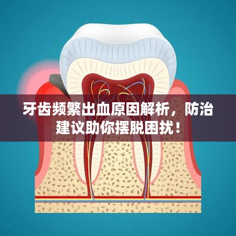牙齒頻繁出血原因解析，防治建議助你擺脫困擾！